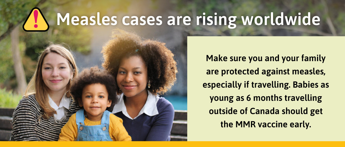 Measles cases are increasing worldwide. Make sure you and your family are protected against measles, especially if travelling. Babies as young as 6 months travelling outside of Canada should get the MMR vaccine early.